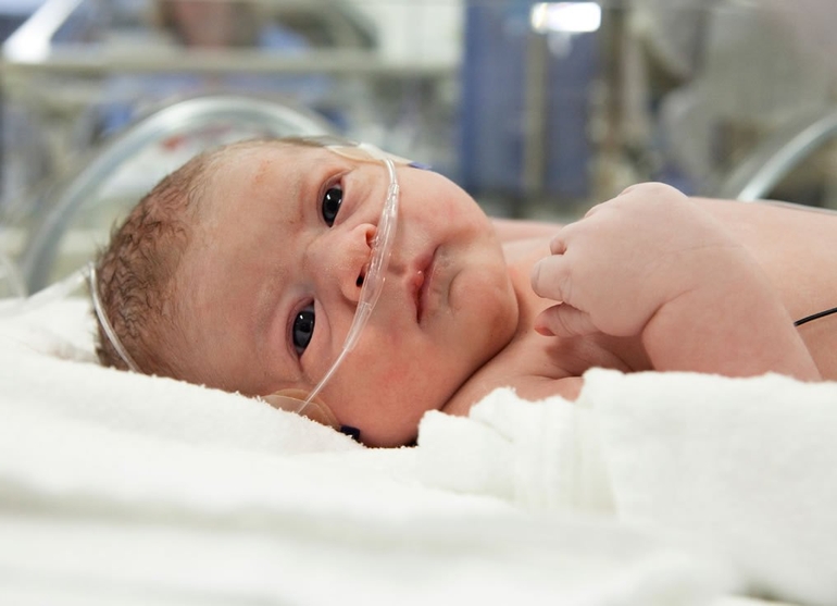 Последствия гипоксии головного мозга у новорожденных