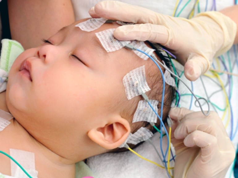 Сделать ЭЭГ (Электроэнцефалографию) ребенку