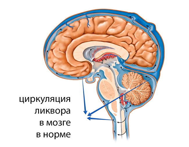 Циркуляция ликвора в мозге