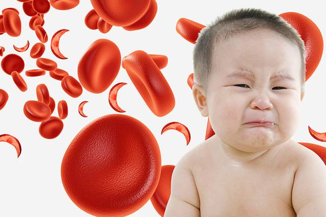 Железодефицитная анемия у детей раннего возраста