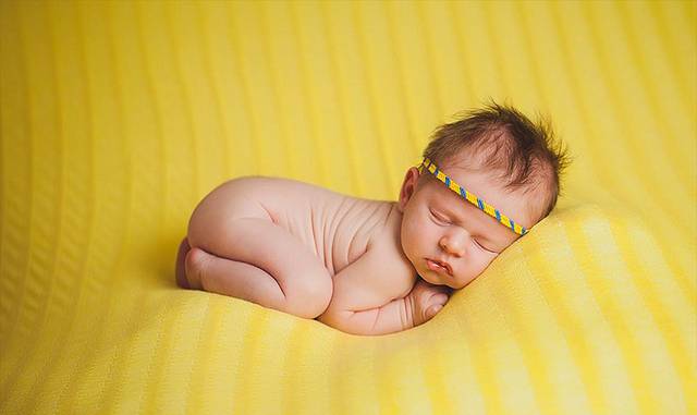 Физиологическая желтуха новорожденных